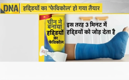 China Bone Glue: अब 3 मिनट में जुड़ेगी टूटी हड्डी, चीन ने खोजा हड्डियों का चमत्कारी 'फेविक्विक'!